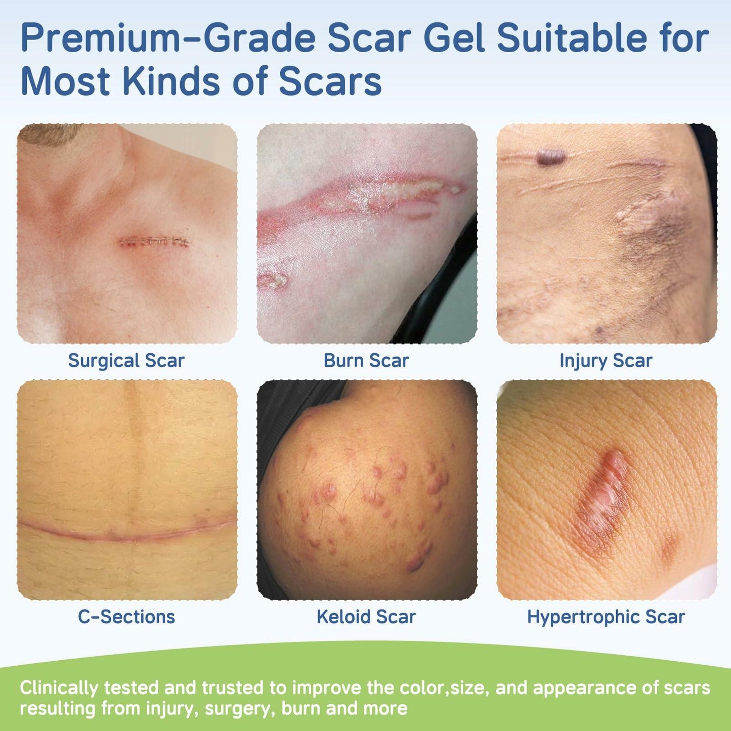 BestBy06/27 SLUKHIG Silicone Scar Gel 1.76oz Surgical & Burn Scar TreatmentCream