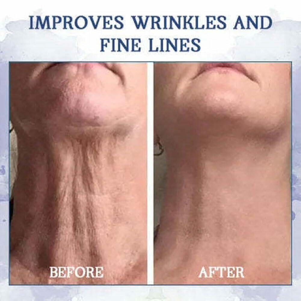 Dizifinn Advanced Firming & Wrinkle-Reducing Cream – 2pc, 50ml Each