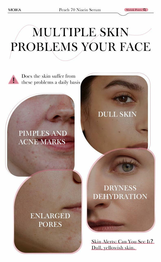 Moika Peach 70 Niacinamide Serum 30ml Hydrating Brightening Face Serum - New