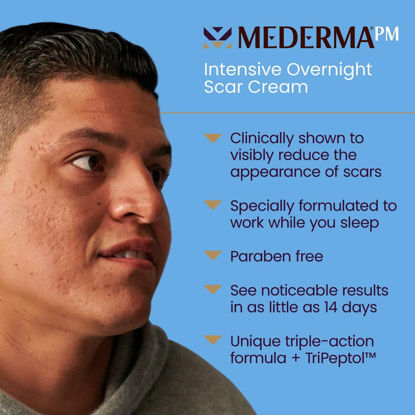 BestBy09/25 Mederma PM Intensive Overnight Scar Cream 1.0 Oz 28g