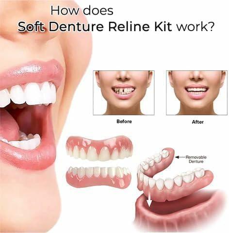 Greatfit Denture Silicone Reline Kit Soft 2pcs for Men and Women