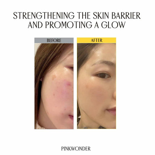 PINKWONDER Jojoba VitaCream 3.38oz Face Moisturizer B12 Panthenol Sensitive Skin