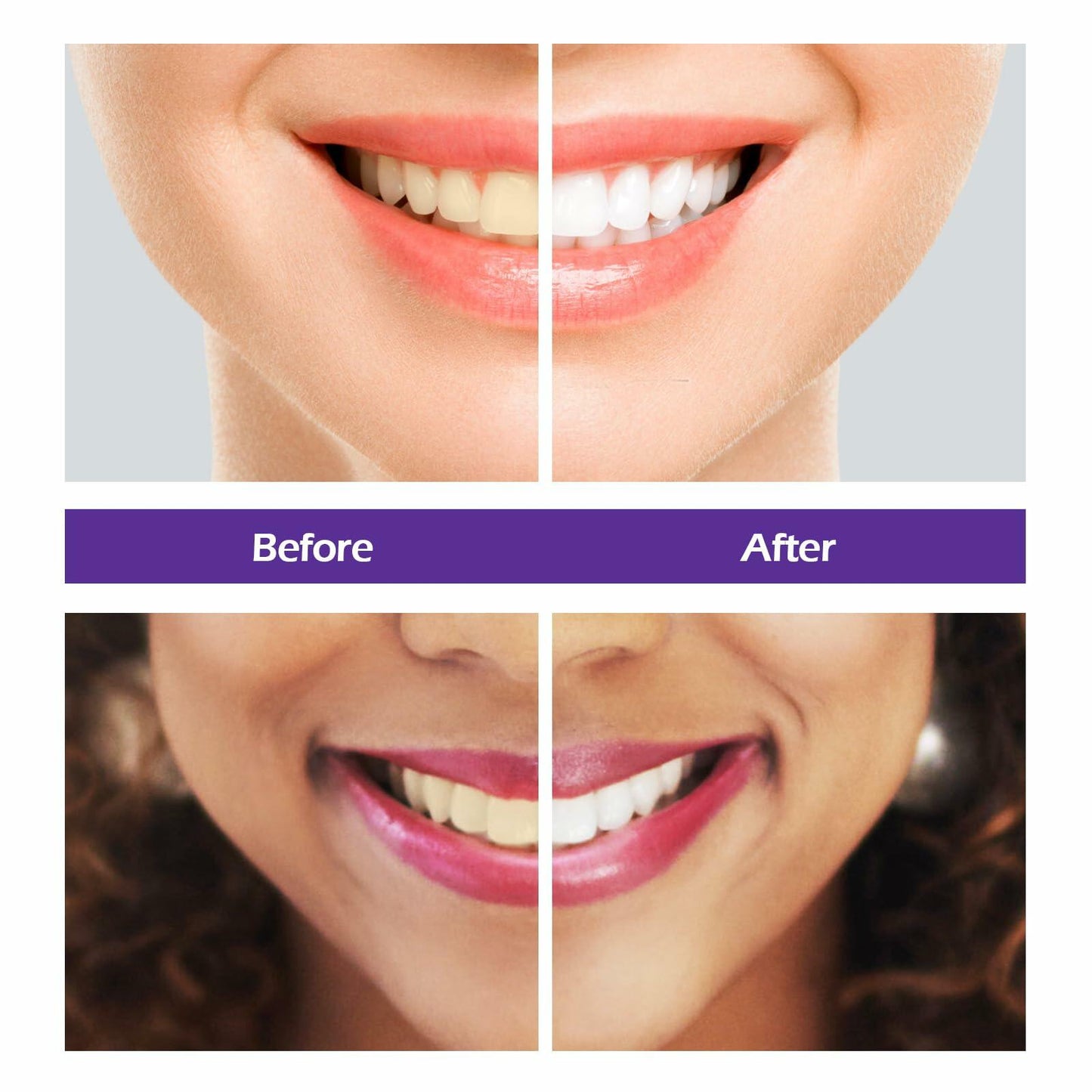 BestBy10/25 Rabbitooth Purple Teeth Whitening Serum 30ml Non-invasive Zero