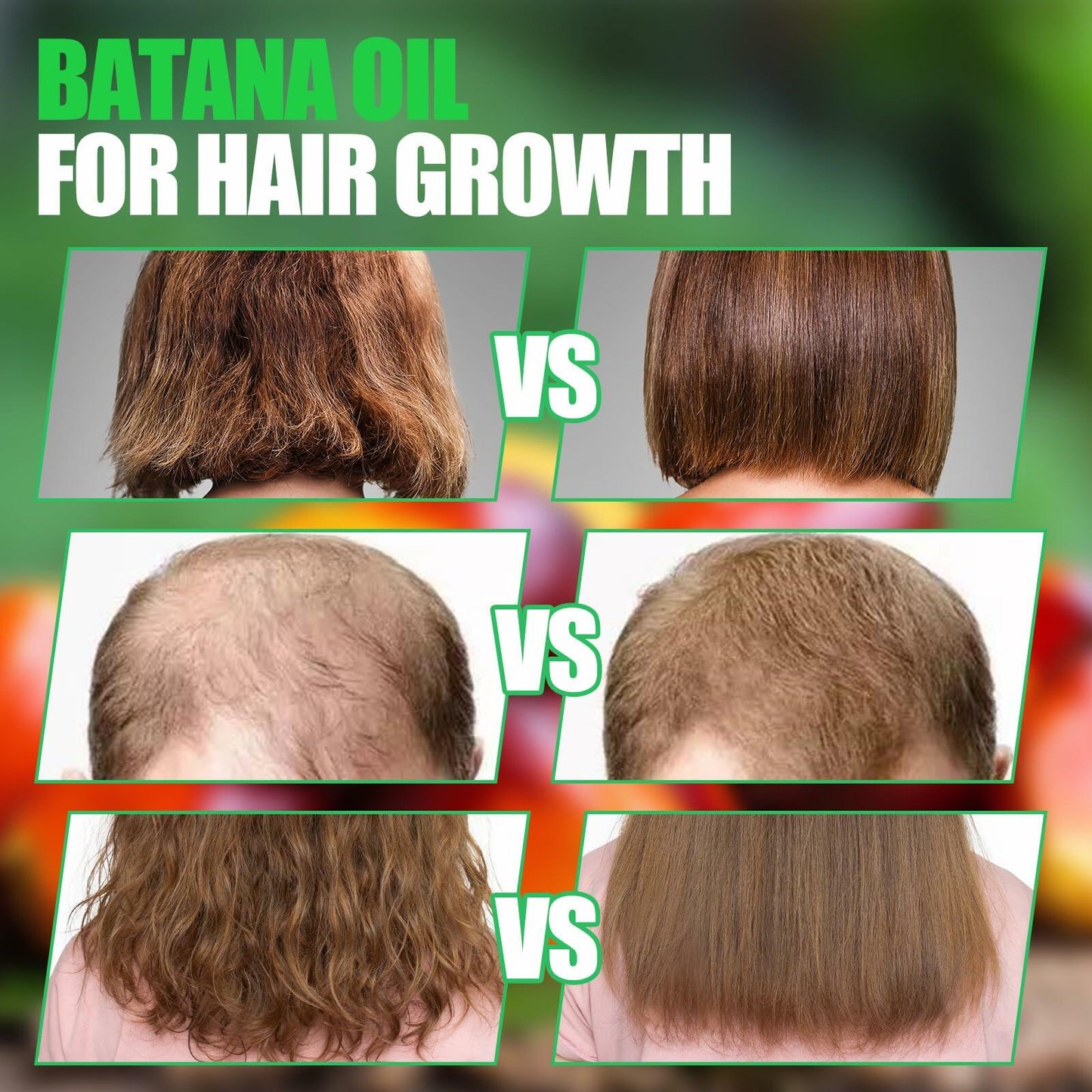 Dr Sebi Batana Oil 2 Pack 100% Natural Organic Hair Growth Oil Honduras