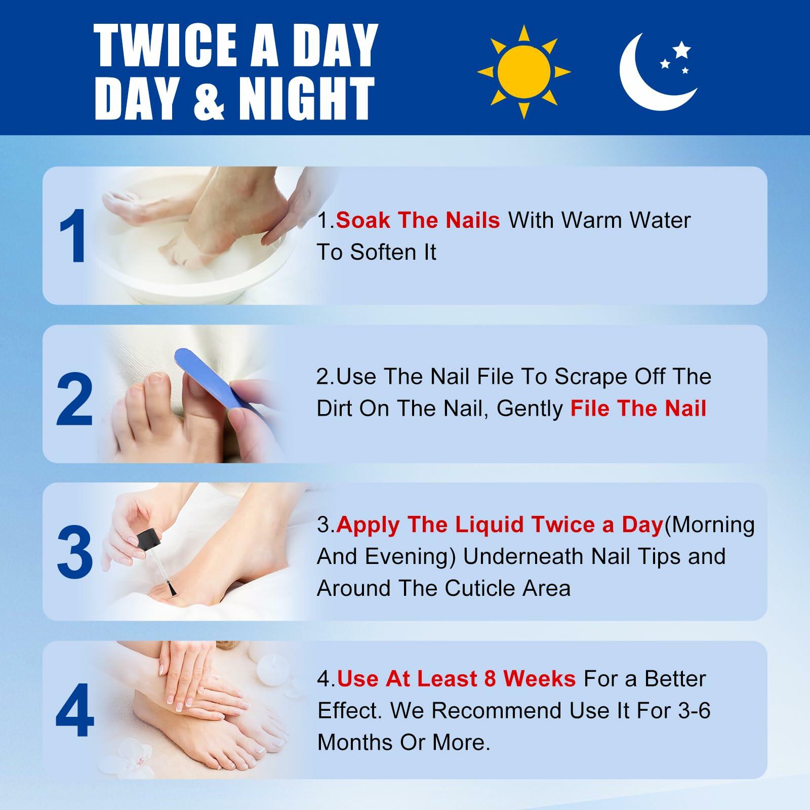 Wunila Toenail Fungus Treatment Extra Strength 30ml Multi-Purpose Nail Repair