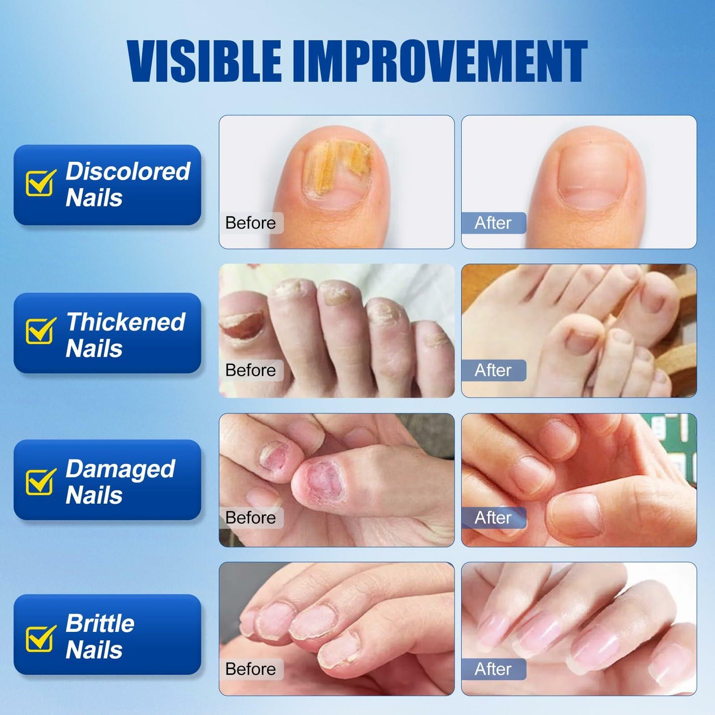 Wunila Toenail Fungus Treatment Extra Strength 30ml Multi-Purpose Nail Repair