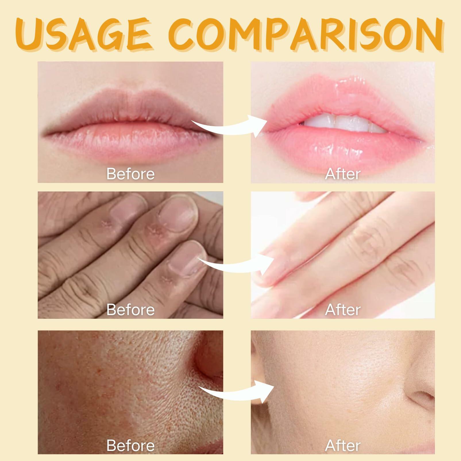 6PCS Skin Care Set Vitamin E Antioxidant Hydrating Kit for Women with Lip Balm