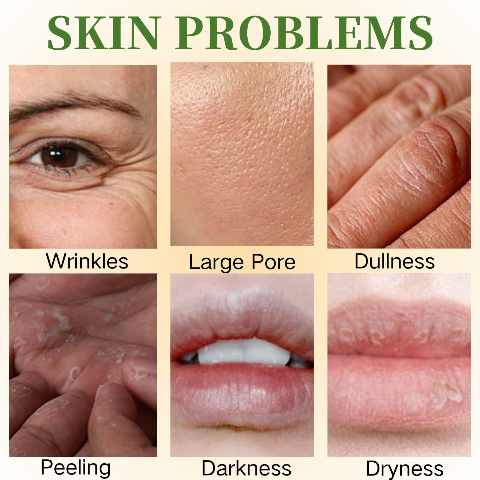 6PCS Skin Care Set Vitamin E Antioxidant Hydrating Kit for Women with Lip Balm