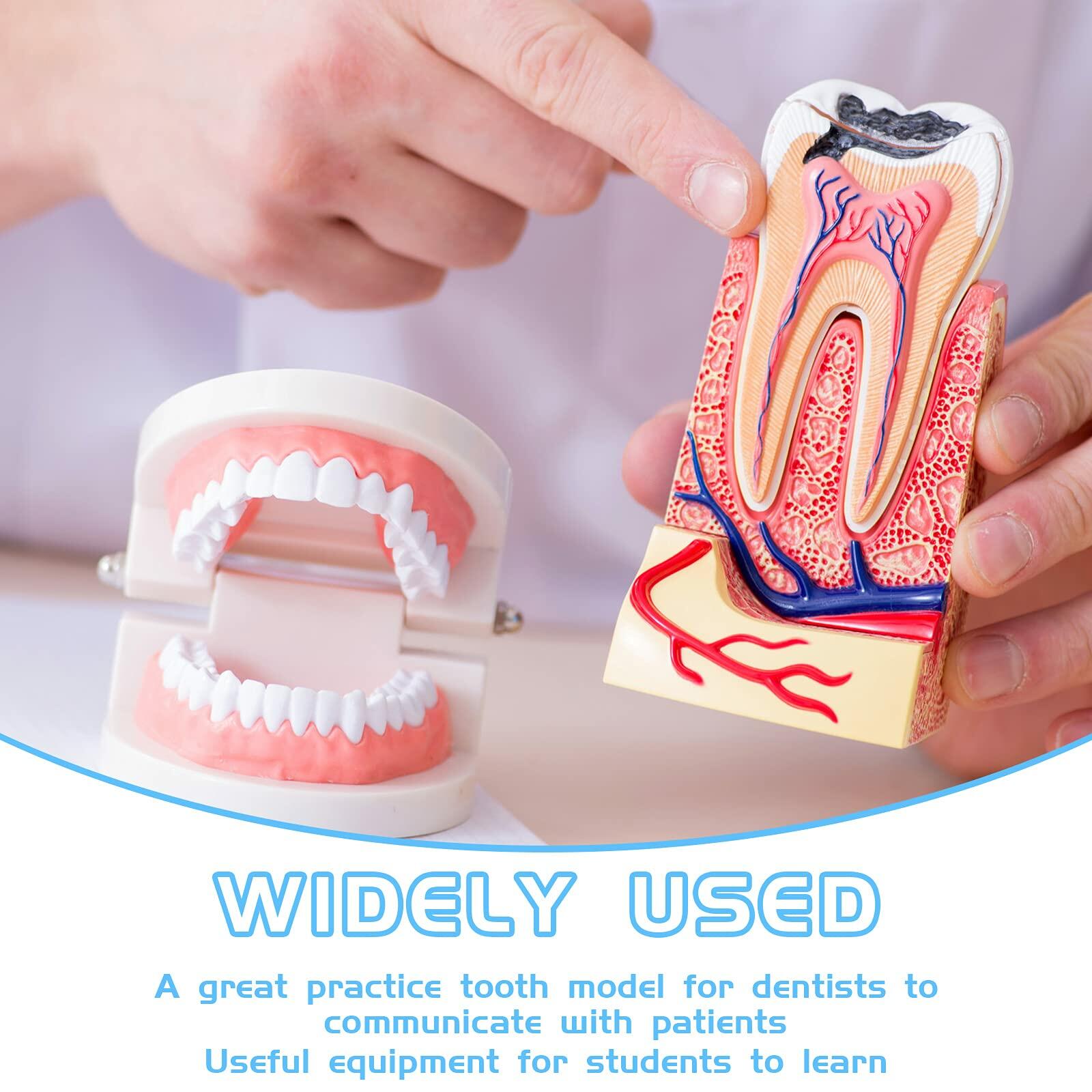 BBTO 2 Pack Dental Teeth Model Fake Dentures Toy Teaching Study