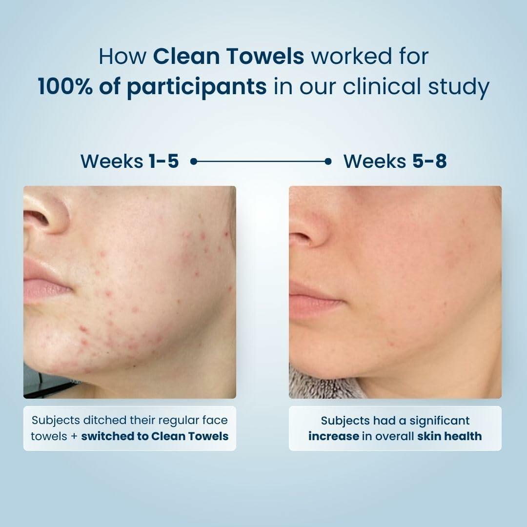 CLEAN SKIN Clean Towels 100% Biobased Face Towel UltraSoft 100ct 4pk Size US 100