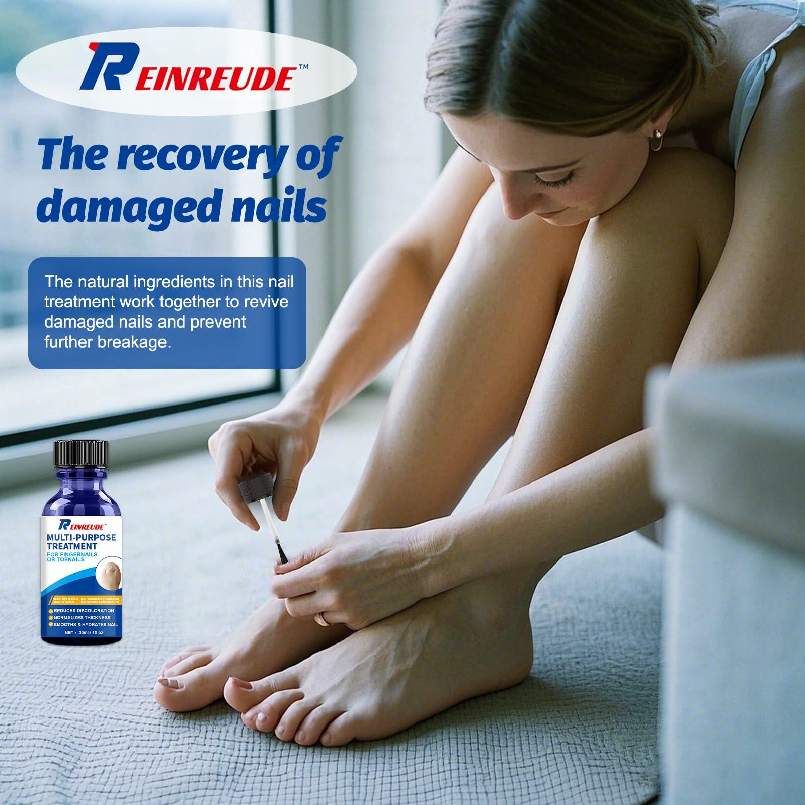 BestBy01/27 Toenail Fungus Treatment Extra Strength with Tolnaftate MultiPurpose