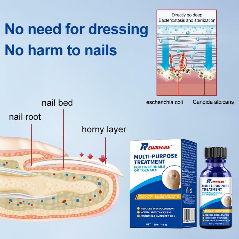 BestBy01/27 Toenail Fungus Treatment Extra Strength with Tolnaftate MultiPurpose