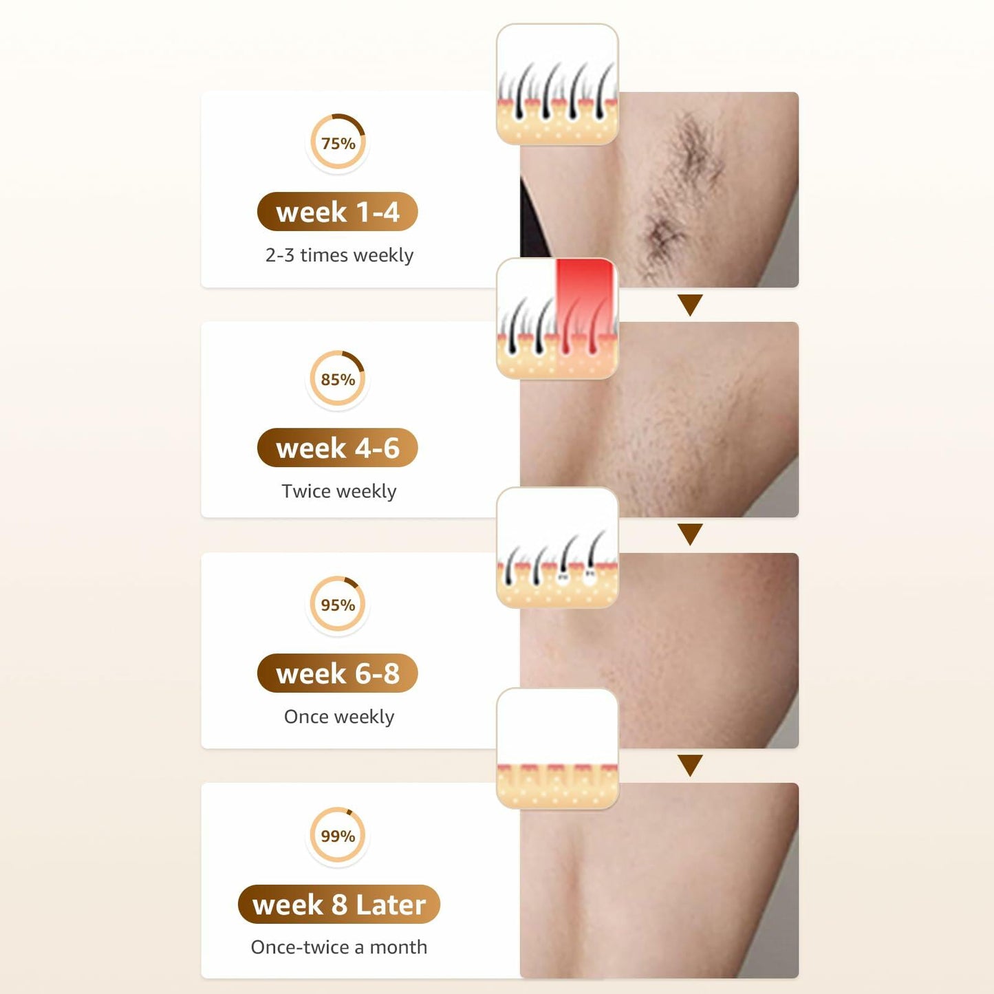 Rodzon IPL Laser Hair Removal Device Painless Care for Women White