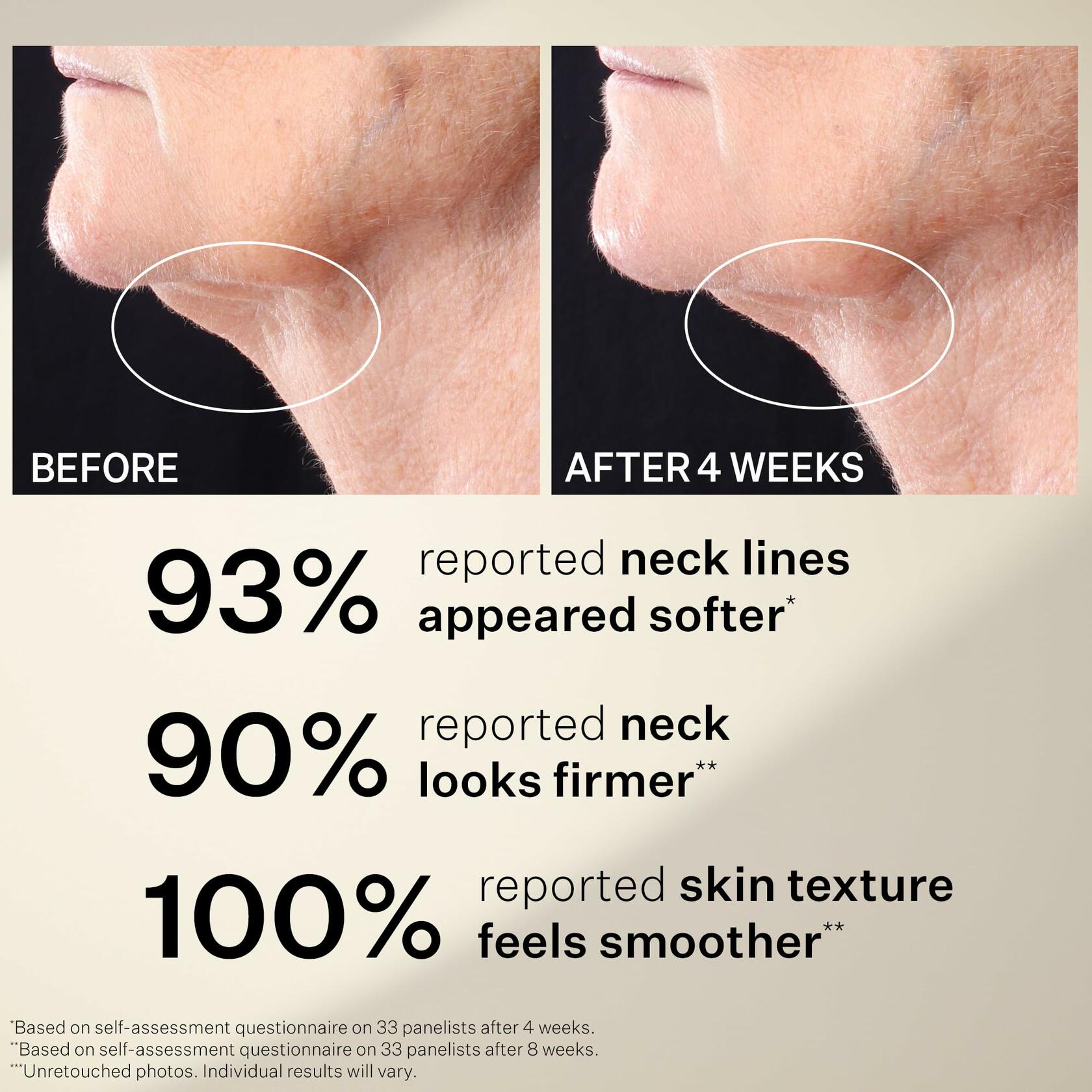StriVectin Peptight Tightening Neck Serum Roller 1.7 fl oz White