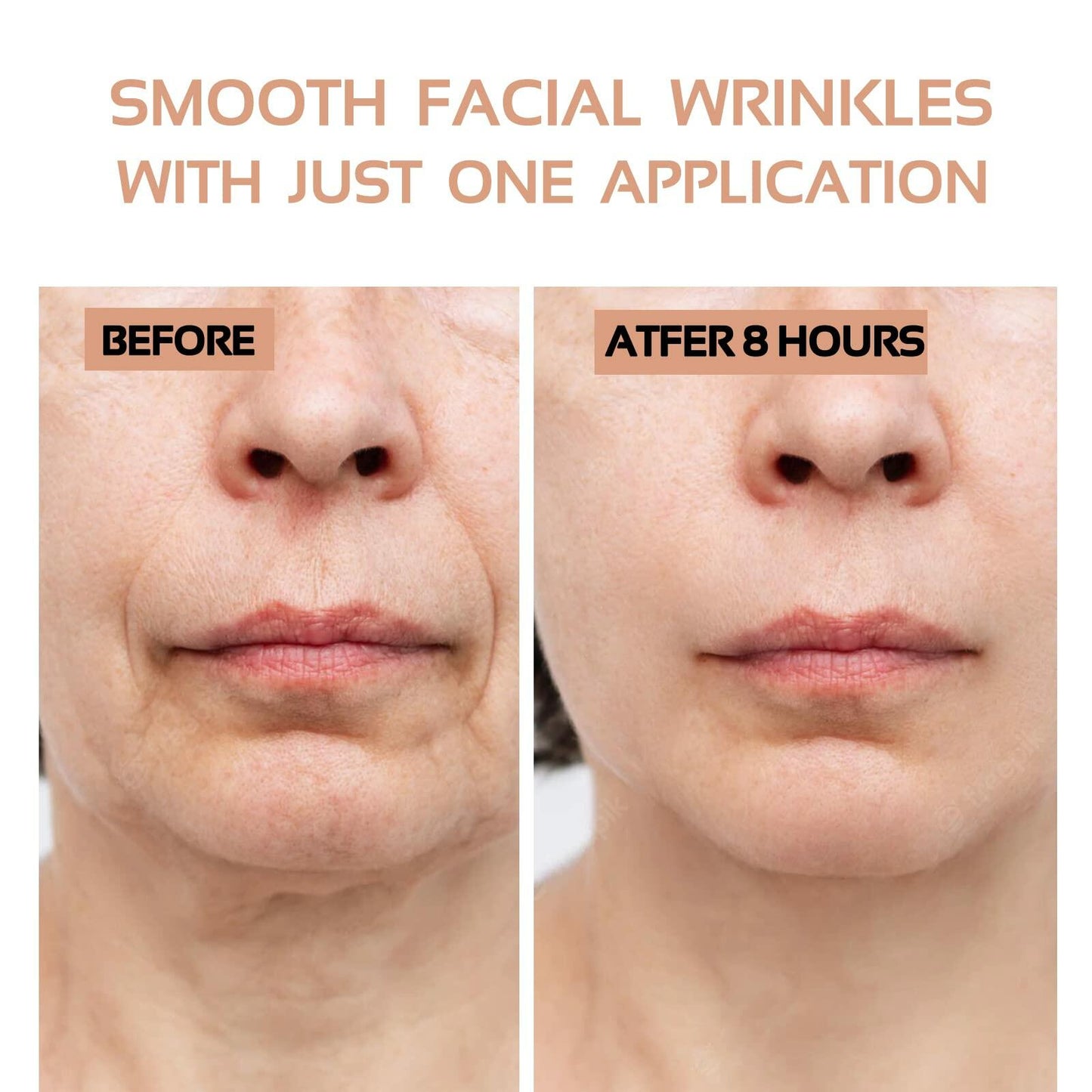 ENROSLU Face Wrinkle Patches 256Pcs Clear Reusable Anti-Wrinkle Treatment