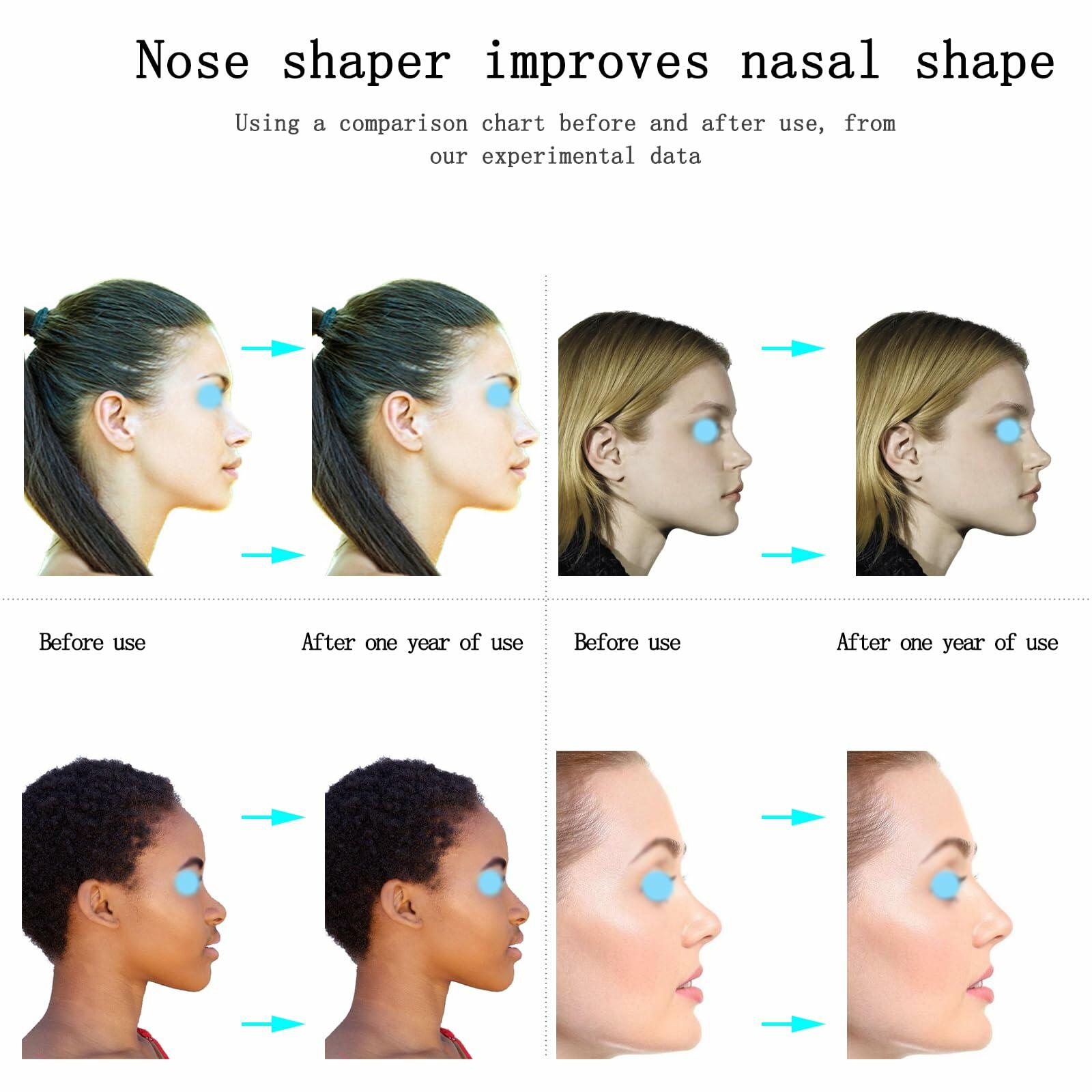 jieri Silicone Nose Shaper Lifter Clip Pain-Free Blue Nose Corrector