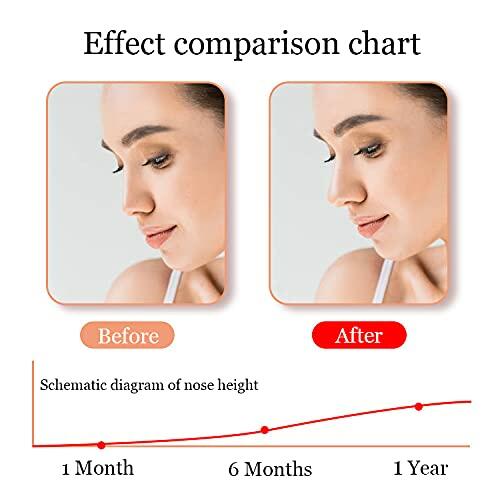 jieri Silicone Nose Shaper Lifter Clip Pain-Free Blue Nose Corrector