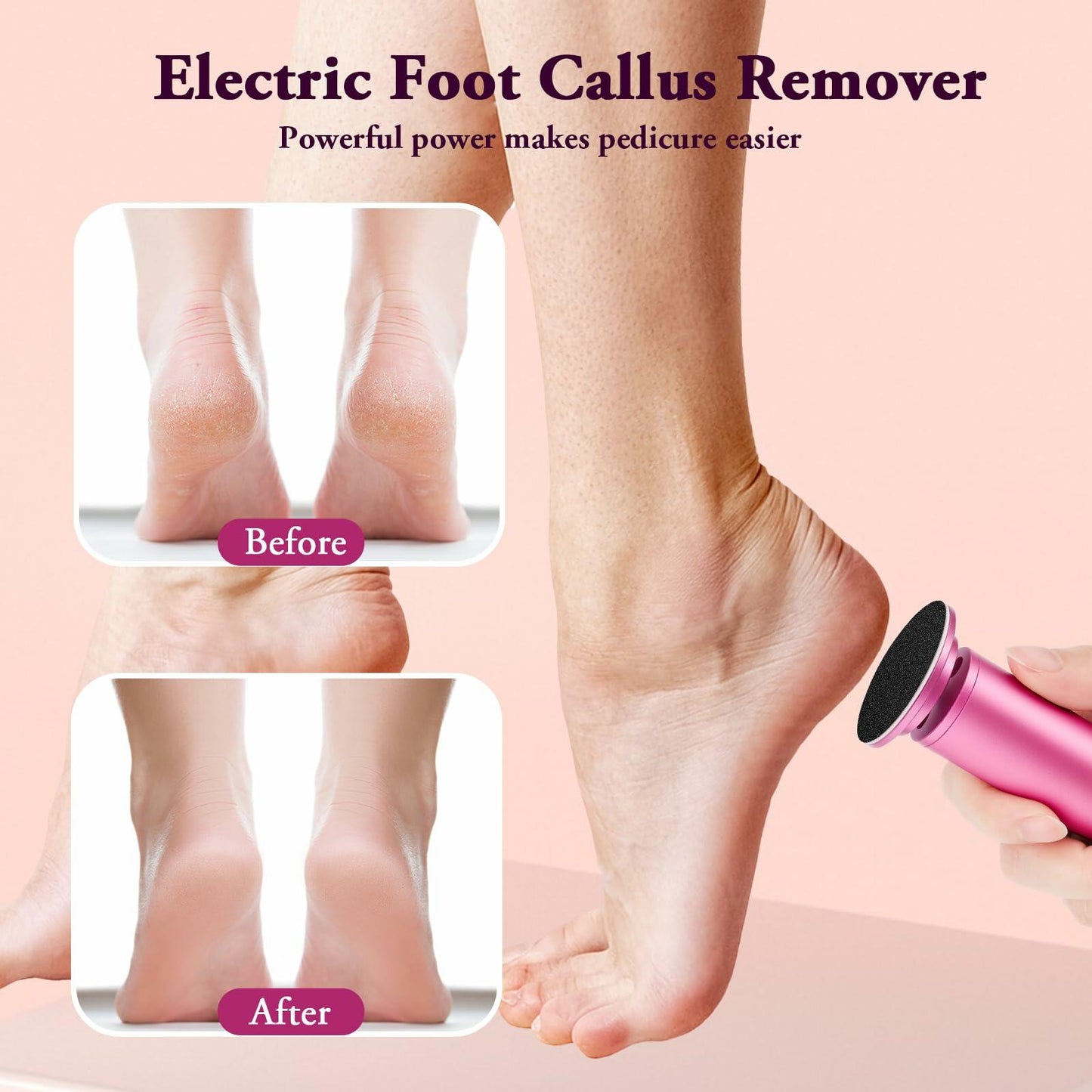 AFFLAT Electric Foot Callus Remover Adjustable Speed 0-600RPM60 Sandpaper Purple