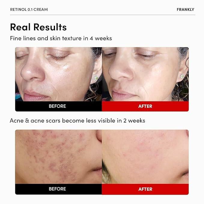 BestBy12/26 FRANKLY Retinol 0.1% Cream 1.01oz Night Anti-Aging Korean Skin Care