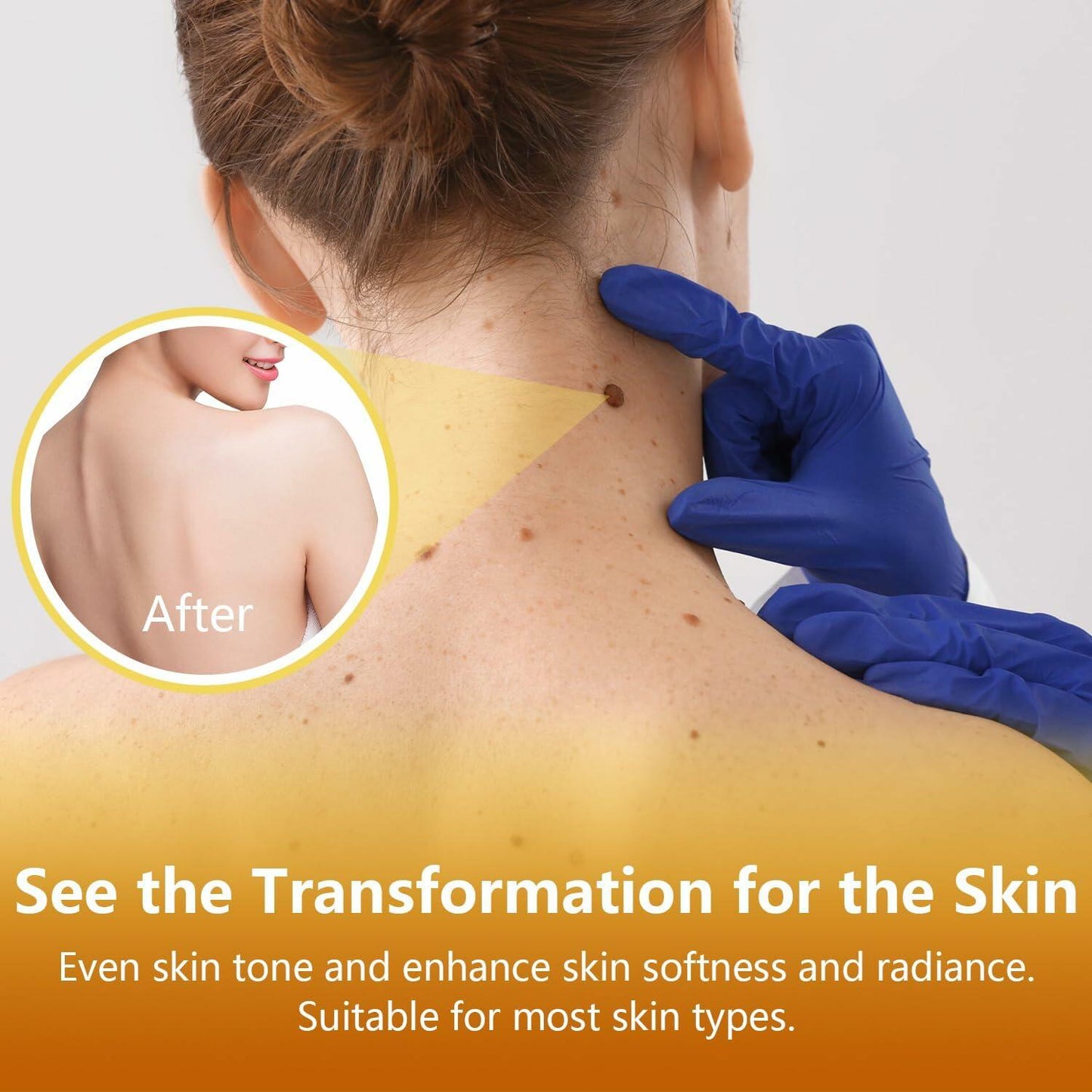 Plresen Bee Venom Skin Treatment Spray Hydrating Moisturizing 2.02oz 2PCS