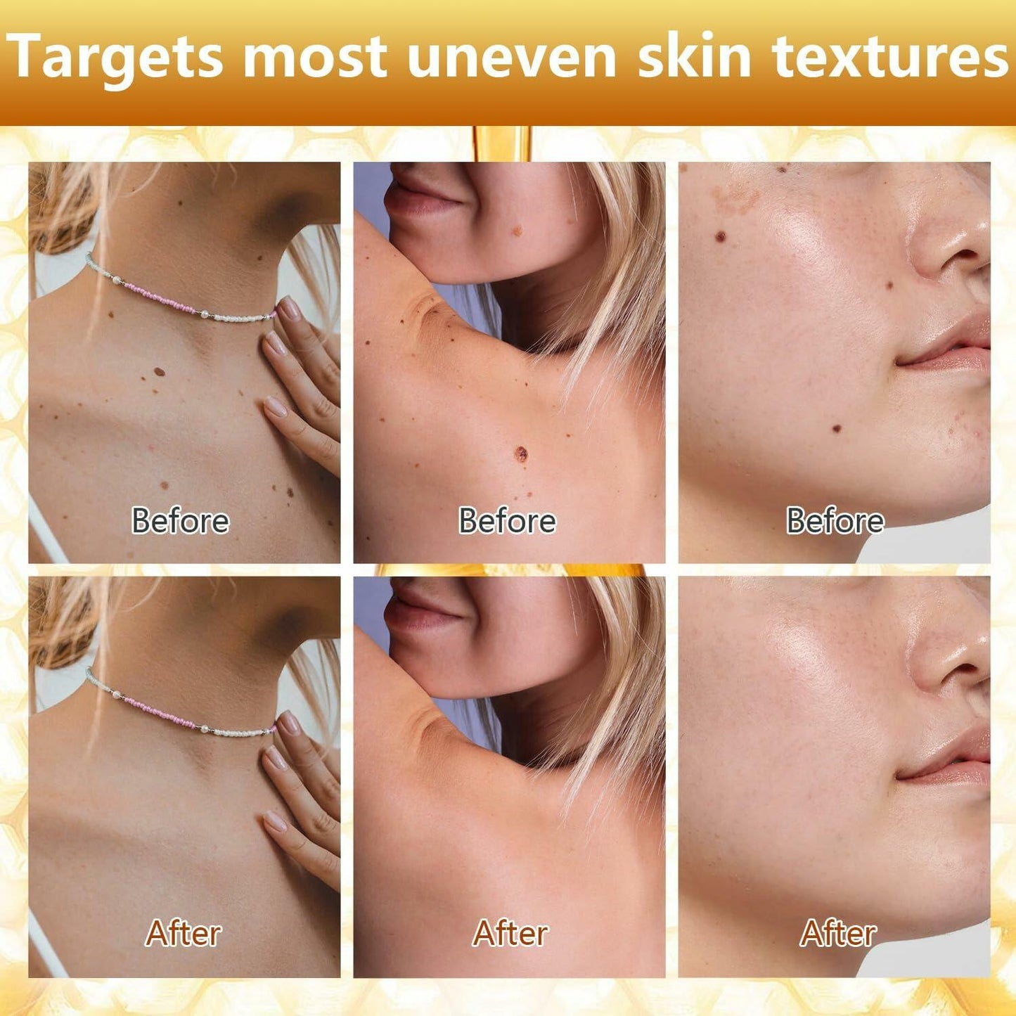 Plresen Bee Venom Skin Treatment Spray Hydrating Moisturizing 2.02oz 2PCS