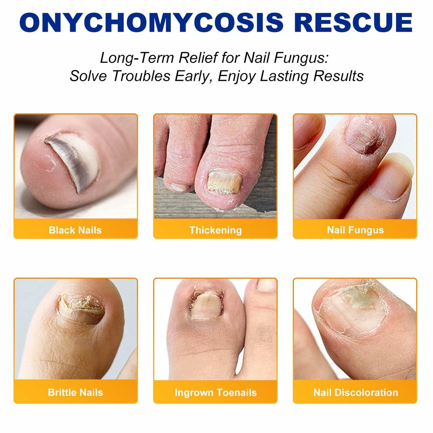 ZAGEVIVIN Fungal Nail Patches 32 Count Beige 8-Hour Overnight Treatment