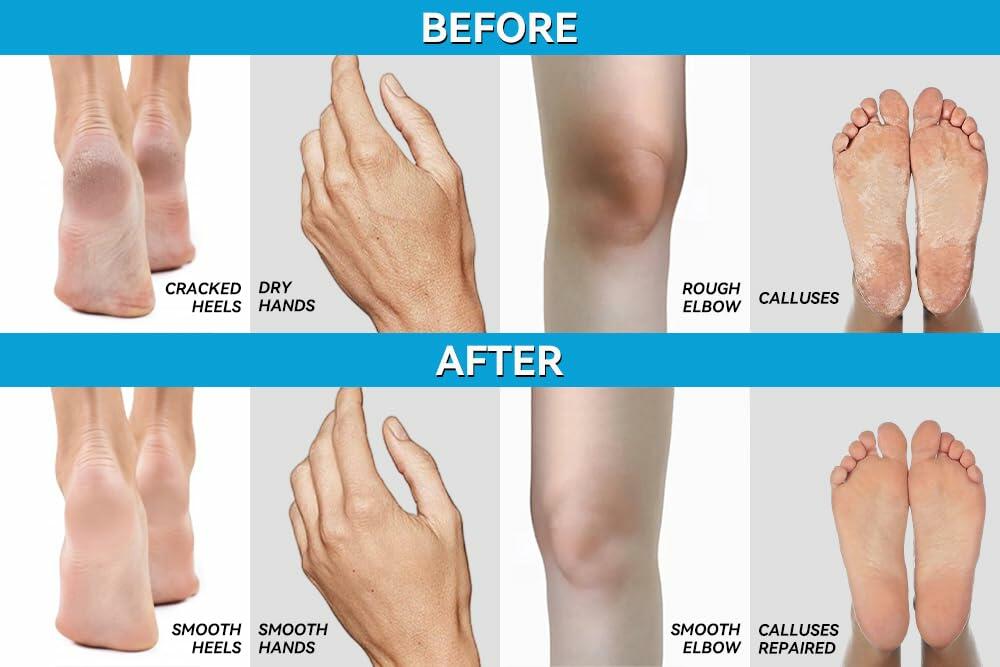 Scientific Solutions Global Urea 40% + 1% Hyaluronic Acid Cream 4oz Clear