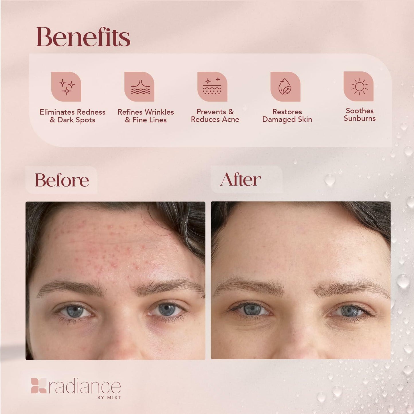 Radiance Snail Mucin Serum 96% Mucin Hyaluronic Acid 100ml Korean Skin Care LIKE