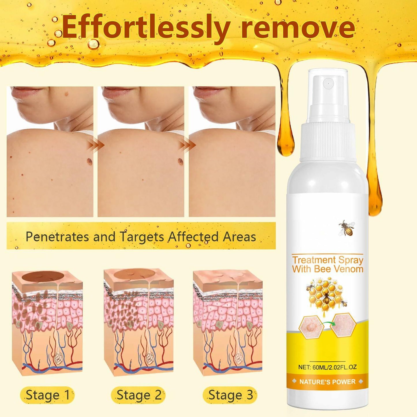 Plresen Bee Venom Skin Treatment Spray Hydrating Moisturizing 2.02oz 2PCS