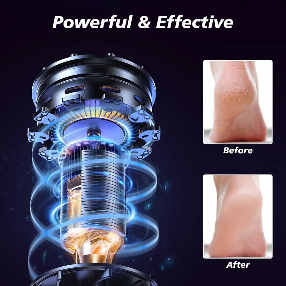 Yreihn Electric Callus Remover for Feet Purple 1 Count ABS Material