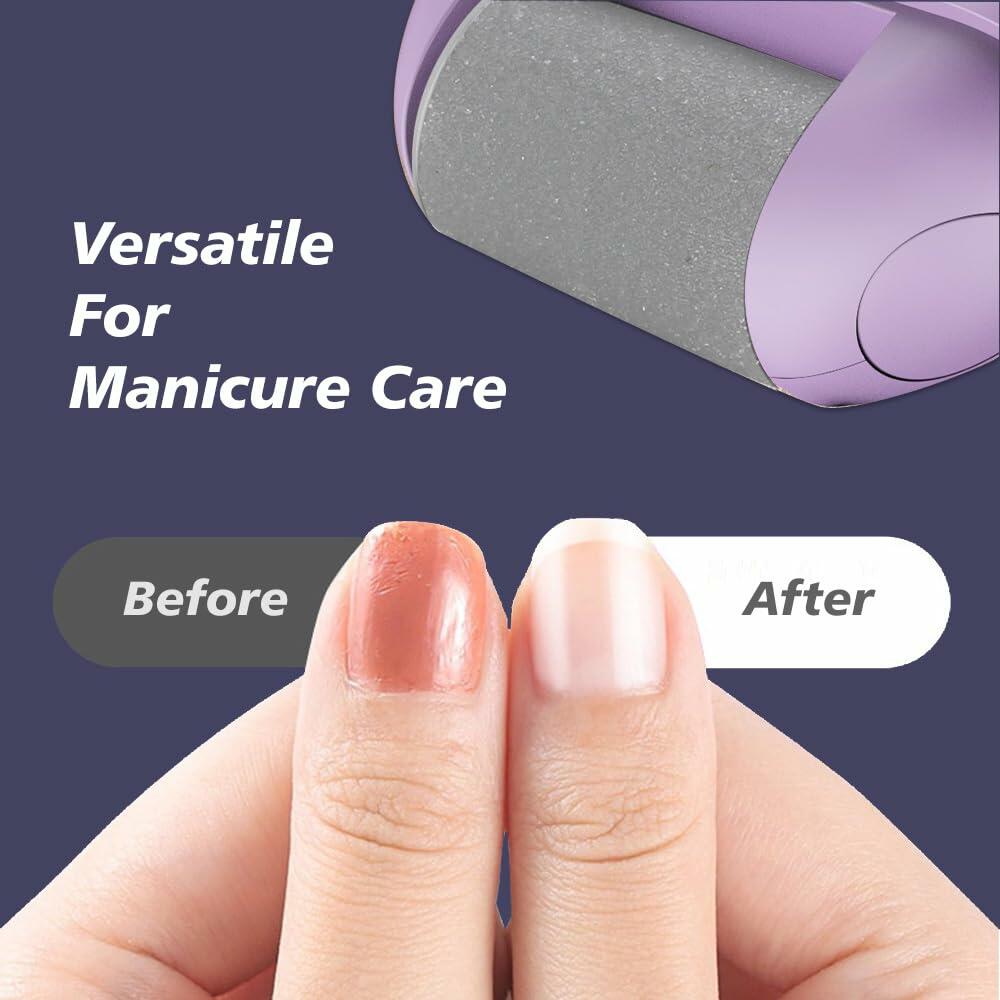 Yreihn Electric Callus Remover for Feet Purple 1 Count ABS Material