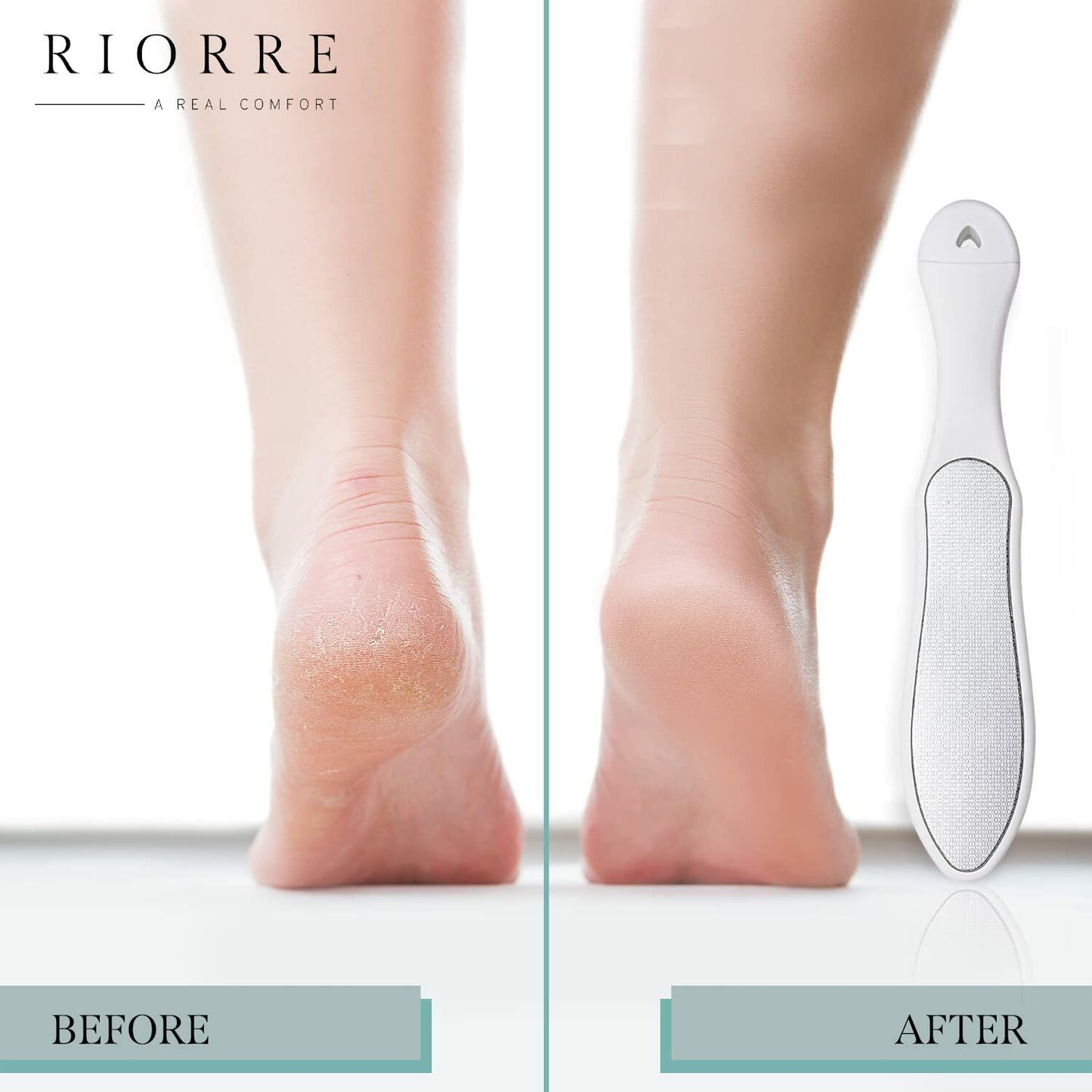 Riorre Professional 3-in-1 Foot Scrubber Callus Remover White Pack 1
