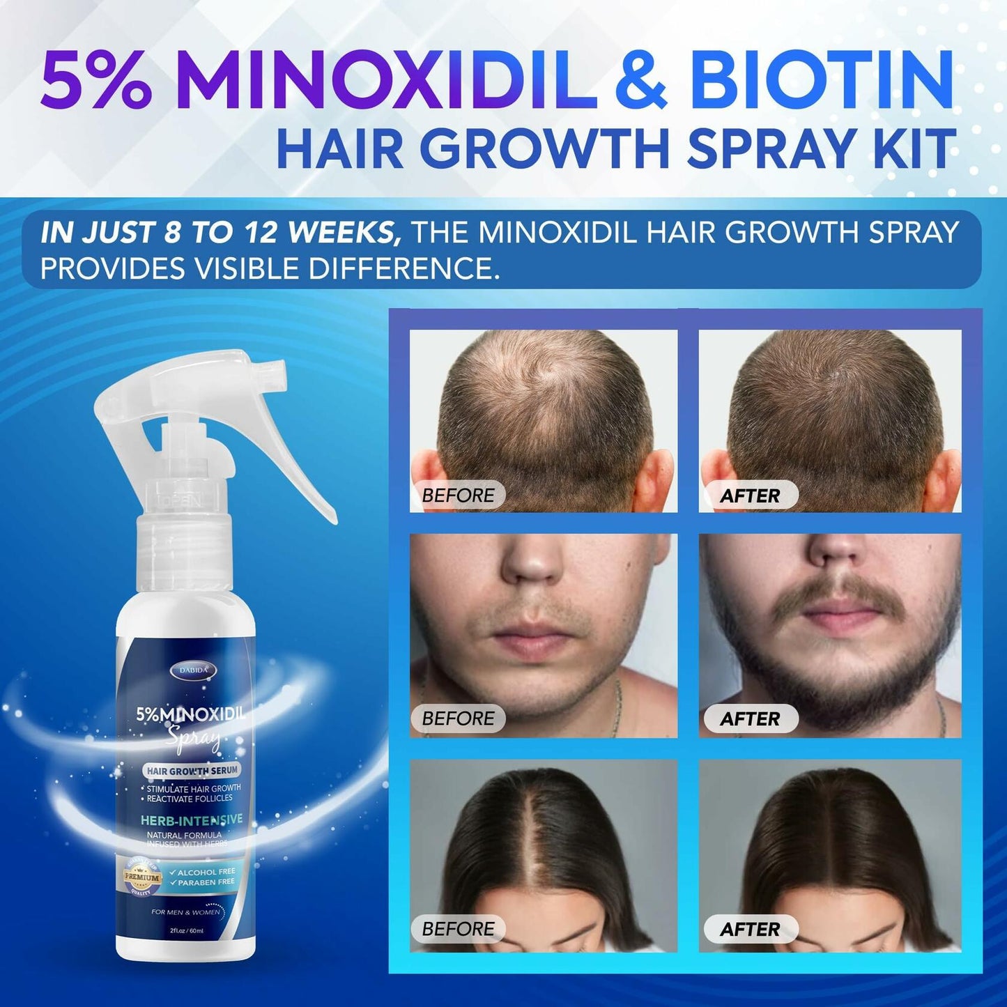 5% Minoxidil Hair & Beard Growth Spray – Men & Women