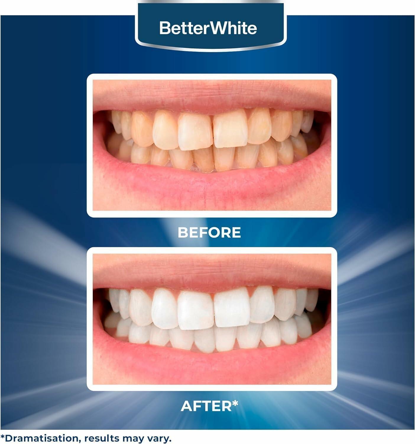 BetterWhite Teeth Whitening Strips 14 Peroxide-Free Professional 7 Treatments