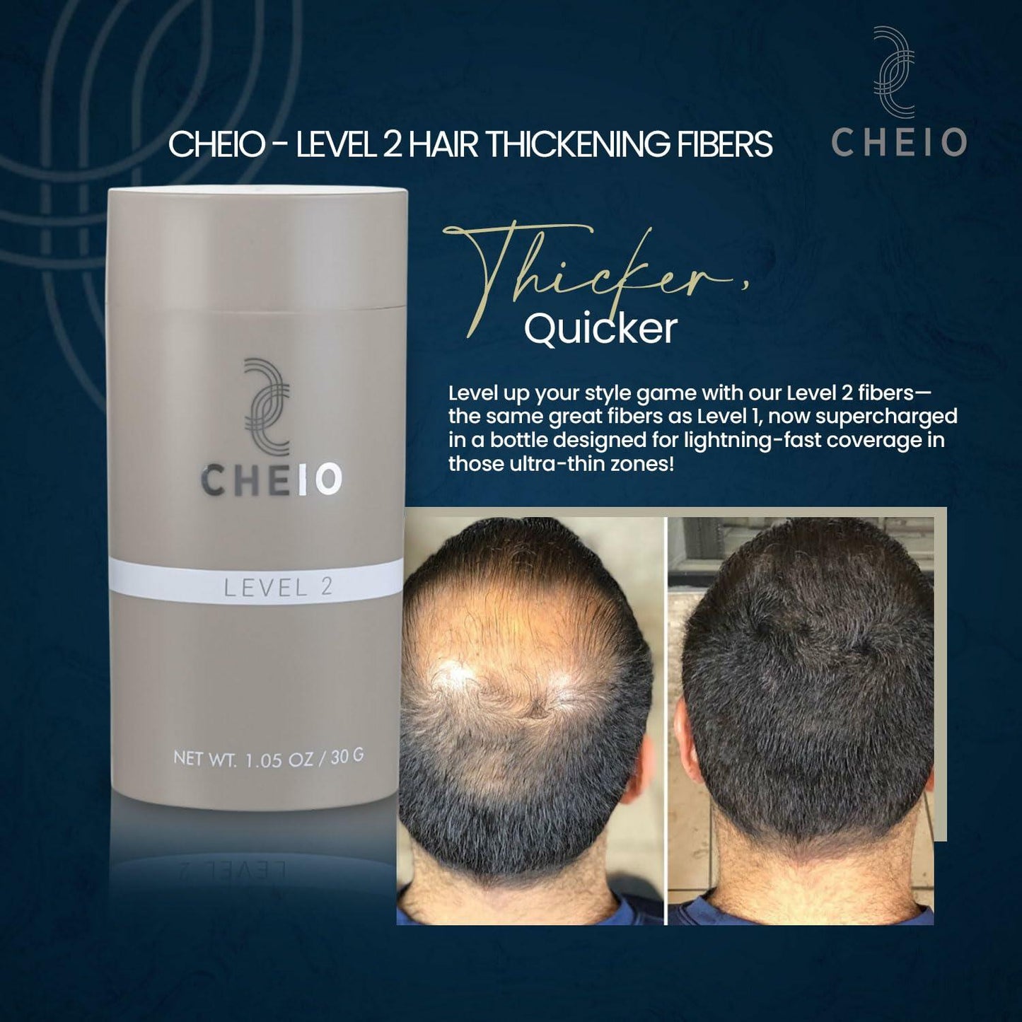 Cheio Hair Thickening Fibers 30g Level 2 Medium Brown Keratin Fibers