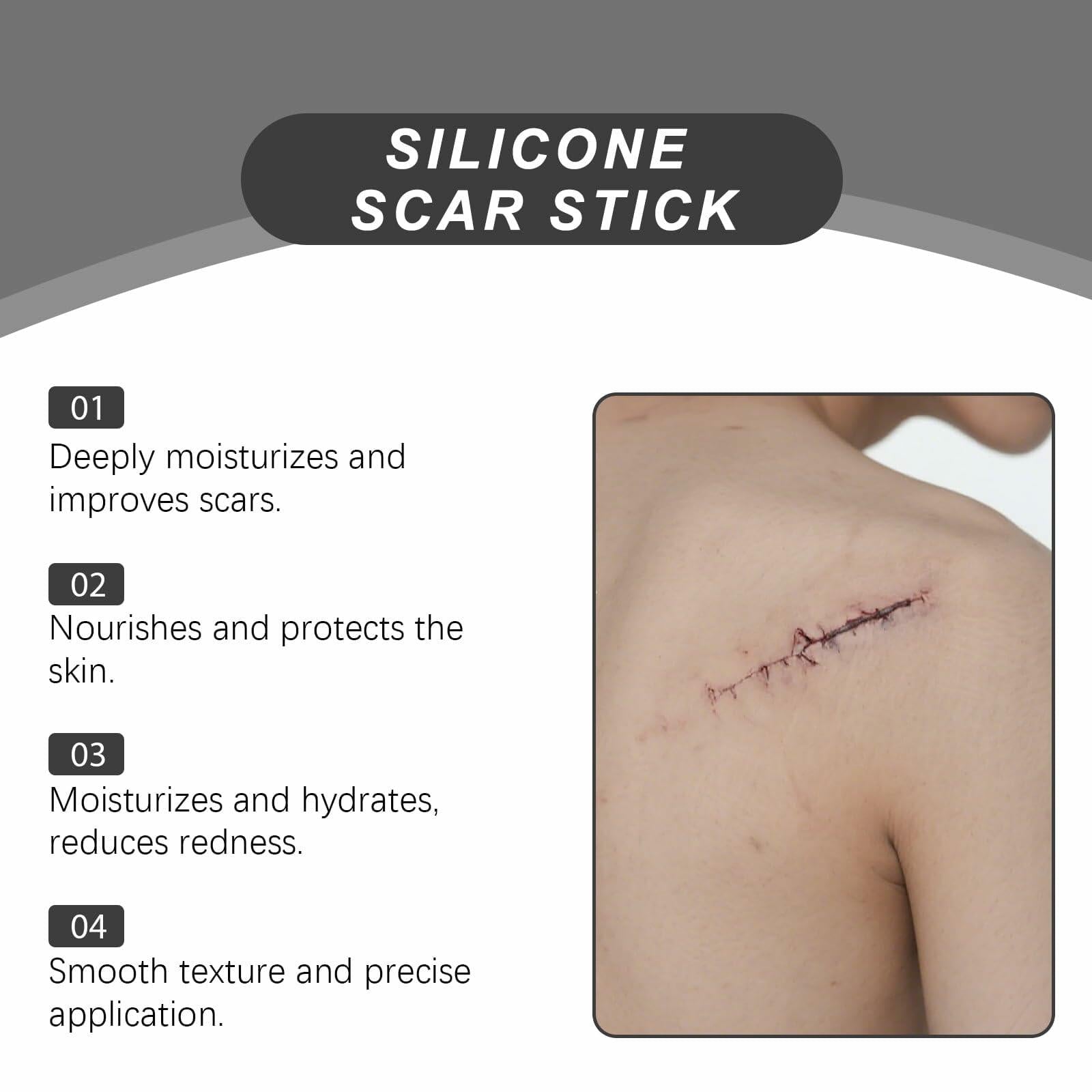 Generic 2PC Silicone Scar Stick 60% Silicone Face Body Moisturizing