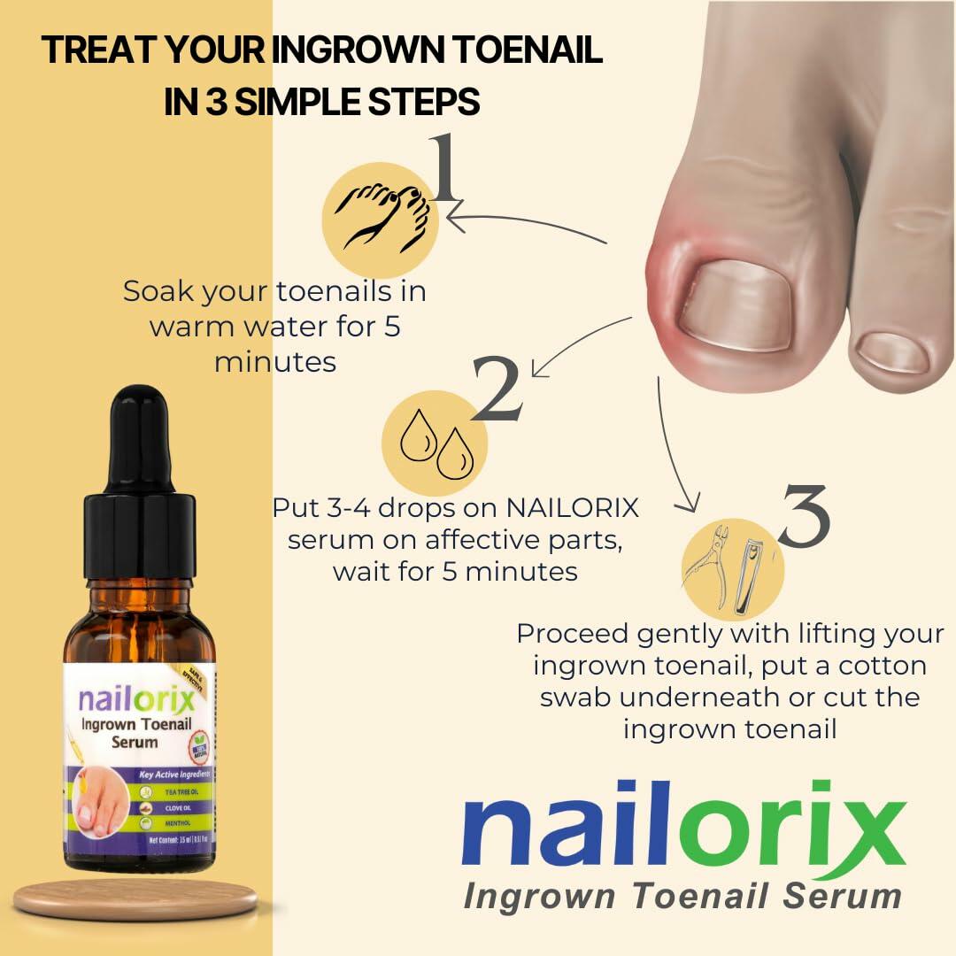 Nailorix Ingrown ToeNail Serum – suitable for your Ingrown Toenail – 15oz