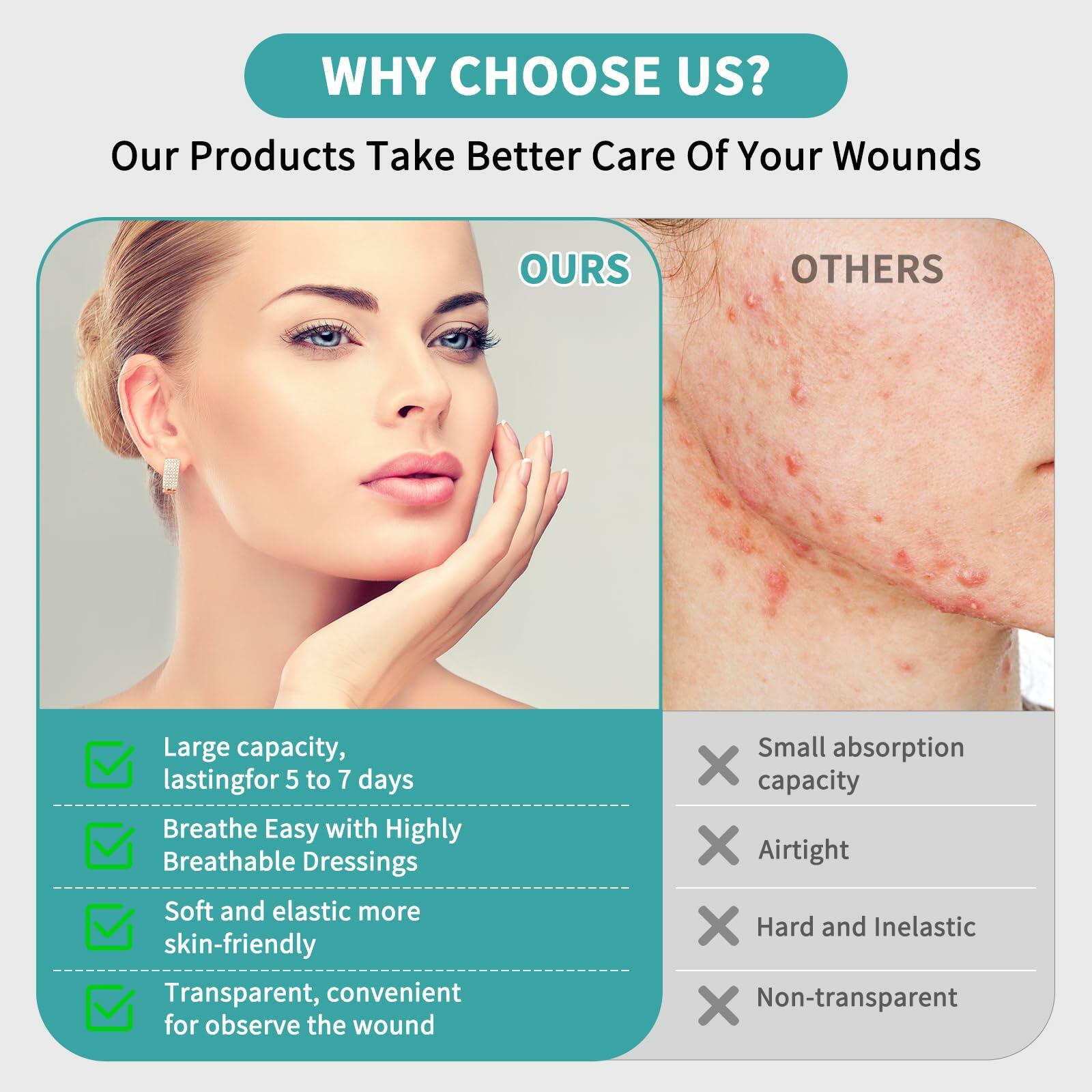 YBYIDU Hydrocolloid Roll Wound Care Bandage Tape 2in x 10ft White