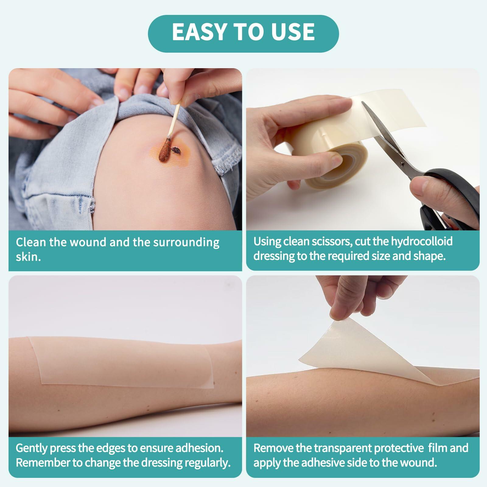 YBYIDU Hydrocolloid Roll Wound Care Bandage Tape 2in x 10ft White