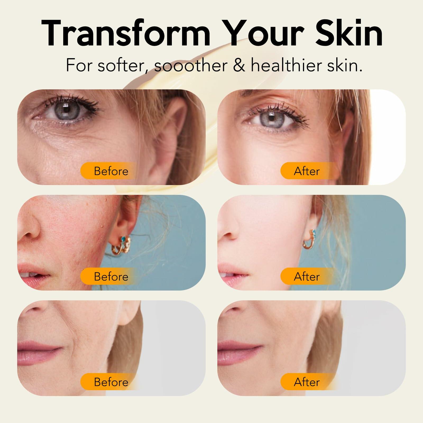 BestBy07/28 Juory Beef Tallow Balm Skin Moisturizer 4oz Honey Calendula Tea Tree